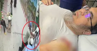 ছুরিকাঘাতের শিকার জাতীয় ক্যান্সার হাসপাতালের উপ-পরিচালক আহমদ হোসেন